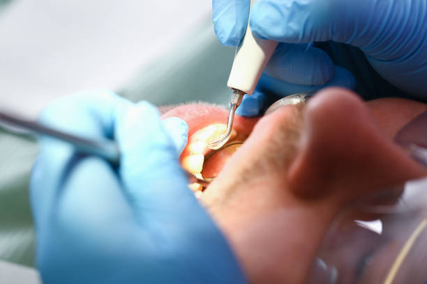 Best Dentist for Tooth Abscess  in Abbotsford, WI