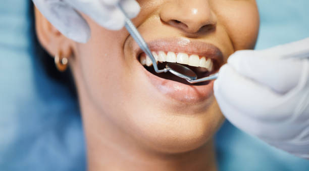 Best Chipped Tooth Repair Near Me  in Abbotsford, WI